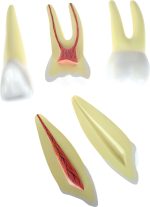 Dantų modeliai 571174