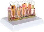 Pagrindinių dantų patologijų modelis 571173 - Image 2